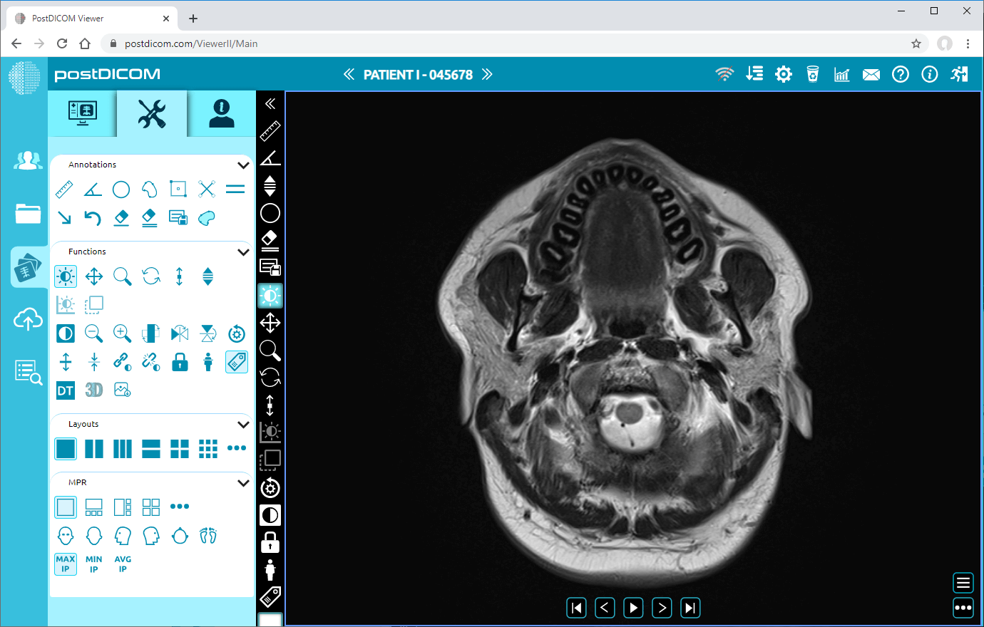 showing and hiding patient information on viewport