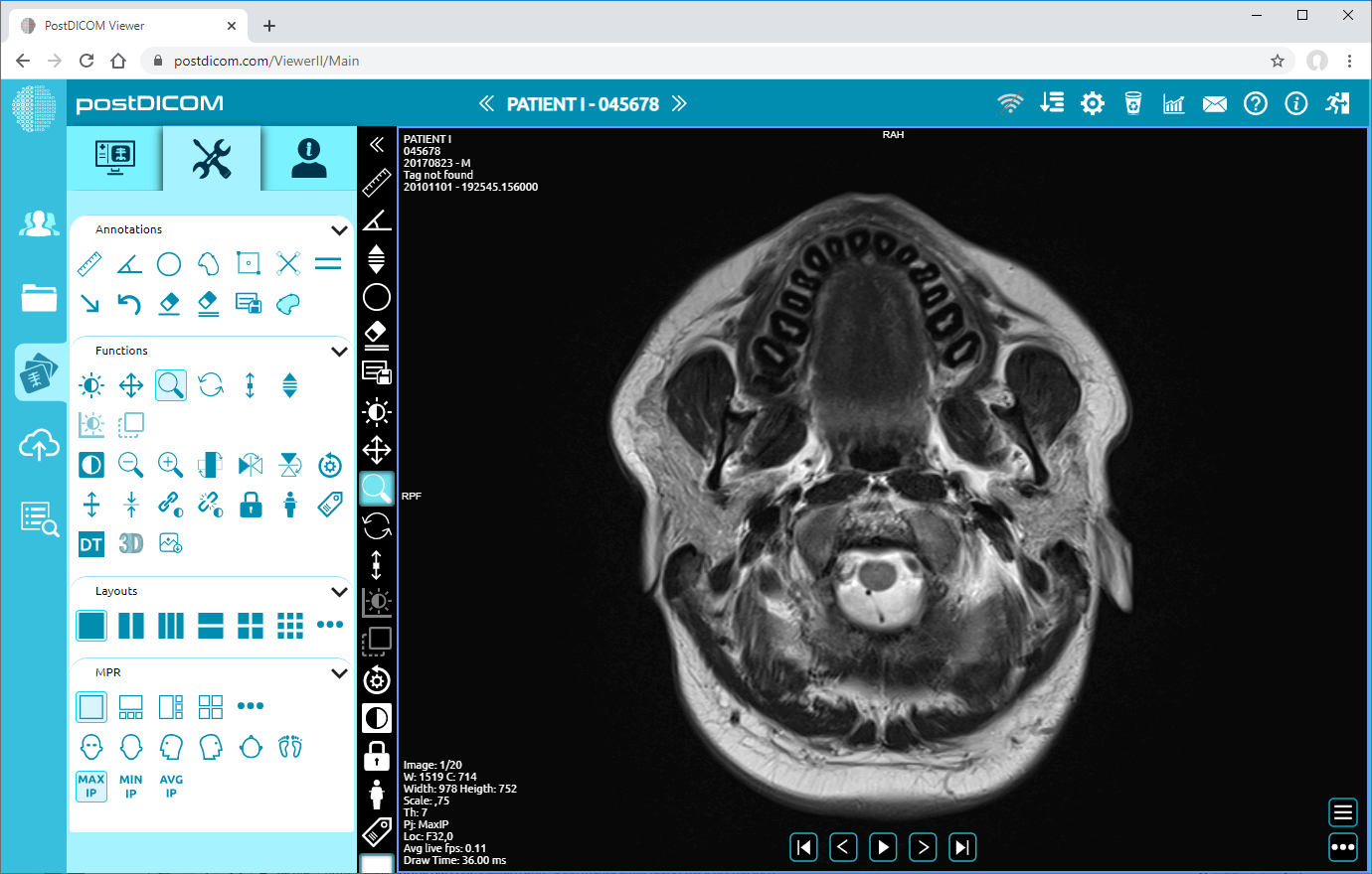 showing and hiding patient information on viewport